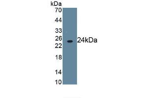 Detection of Recombinant FcgR3B, Human using Monoclonal Antibody to Fc Fragment Of IgG Low Affinity IIIb Receptor (FcgR3B) (FCGR3B antibody  (AA 24-203))