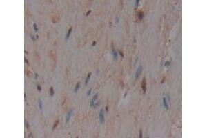 Immunohistochemistry (IHC) image for anti-SMAD Family Member 4 (SMAD4) (AA 323-552) antibody (ABIN1860591)