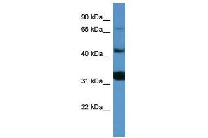 Western Blot showing MFI2 antibody used at a concentration of 1-2 ug/ml to detect its target protein. (MFI2 antibody  (C-Term))