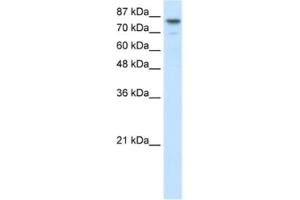 Western Blotting (WB) image for anti-Helicase-Like Transcription Factor (HLTF) antibody (ABIN2460973) (HLTF antibody)
