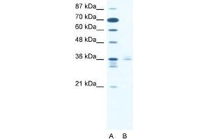 Human Jurkat; WB Suggested Anti-LHX3 Antibody. (LHX3 antibody  (Middle Region))