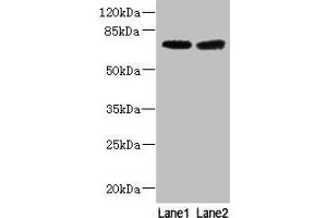 Western blot All lanes: GALNT15 antibody at 5 μg/mL Lane 1: Mouse liver tissue Lane 2: Mouse kidney tissue Secondary Goat polyclonal to rabbit IgG at 1/10000 dilution Predicted band size: 74 kDa Observed band size: 74 kDa (GALNT14 antibody  (AA 35-335))
