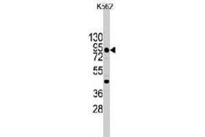 Western blot analysis of CDH3 (arrow) using rabbit CDH3 polyclonal antibody  in K-562 cell line lysates (35 ug/lane). (P-Cadherin antibody  (C-Term))