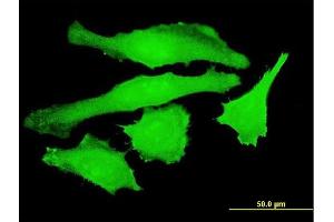 Immunofluorescence of monoclonal antibody to USP10 on HeLa cell. (USP10 antibody  (AA 699-797))
