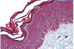 Human Skin (formalin-fixed, paraffin-embedded) stained with PERP antibody ABIN213966 at 5 ug/ml followed by biotinylated goat anti-rabbit IgG secondary antibody ABIN481713, alkaline phosphatase-streptavidin and chromogen. (PERP antibody  (C-Term))