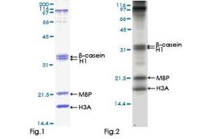 CAMKV Protein (AA 1-501) (GST tag)