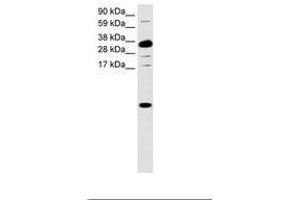 Image no. 1 for anti-Chemokine (C-X-C Motif) Ligand 1 (Melanoma Growth Stimulating Activity, Alpha) (CXCL1) (C-Term) antibody (ABIN6736034) (CXCL1 antibody  (C-Term))
