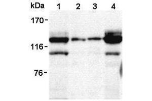 Western Blotting (WB) image for anti-Signal-Induced Proliferation-Associated 1 (SIPA1) antibody (ABIN1449260) (SIPA1 antibody)