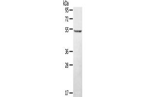 Western Blotting (WB) image for anti-serine/threonine/tyrosine Kinase 1 (STYK1) antibody (ABIN2427348) (STYK1 antibody)
