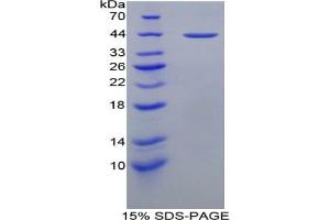 SDS-PAGE analysis of Mouse PRG2 Protein. (Major Basic Protein Protein)