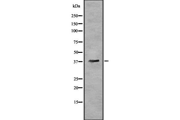 OR5T3 antibody