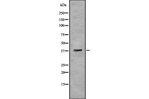 Western blot analysis OR5T3 using HeLa whole cell lysates (OR5T3 antibody)
