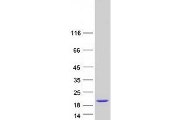 CCDC153 Protein (Coiled coil domain) (Myc-DYKDDDDK Tag)