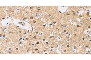 Immunohistochemistry of paraffin-embedded Human brain tissue using FASTK Polyclonal Antibody at dilution 1:30 (FASTK antibody)