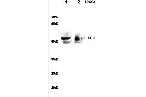 Lane 1: rat brain lysates Lane 2: human colon carcinoma lysates probed with Anti A1BG Polyclonal Antibody, Unconjugated  at 1:200 in 4˚C.