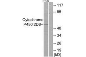 Western blot analysis of extracts from HT-29 cells, using Cytochrome P450 2D6 Antibody. (CYP2D6 antibody  (AA 251-300))