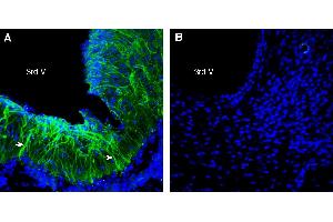 Expression of FSHR in rat hypothalamus. (Follicle Stimulating Hormone Receptor (FSHR) Peptide)