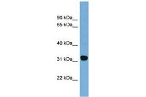 Image no. 1 for anti-Carbonyl Reductase 1 (CBR1) (AA 107-156) antibody (ABIN6744809) (CBR1 antibody  (AA 107-156))