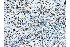 Immunohistochemical staining of paraffin-embedded Human liver tissue using anti-MTRF1L mouse monoclonal antibody.