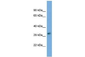 Host:  Rabbit  Target Name:  FKTN  Sample Type:  721_B Whole cell lysates  Antibody Dilution:  1. (Fukutin antibody  (C-Term))