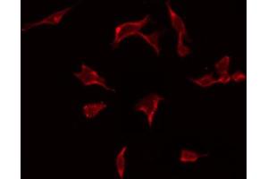 ABIN6274928 staining A549 by IF/ICC. (ARFGEF2 antibody  (N-Term))
