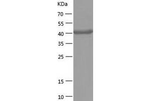 Western Blotting (WB) image for Aminoacylase 1 (ACY1) (AA 1-408) protein (His tag) (ABIN7288522) (Aminoacylase 1 Protein (ACY1) (AA 1-408) (His tag))