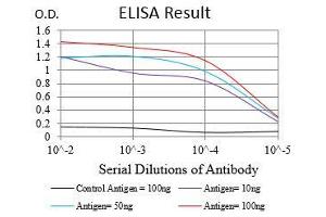 Black line: Control Antigen (100 ng), Purple line: Antigen(10 ng), Blue line: Antigen (50 ng), Red line: Antigen (100 ng), (Nibrin antibody  (AA 467-615))