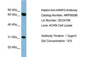 WB Suggested Anti-HIRIP3  Antibody Titration: 0. (HIRIP3 antibody  (Middle Region))