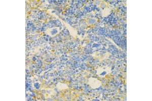 Immunohistochemistry of paraffin-embedded mouse spleen using GPX4 Antibody (ABIN5970997) at dilution of 1/200 (40x lens).