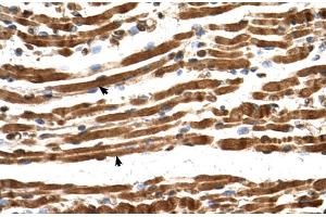 Human Muscle (NARG1L antibody  (Middle Region))