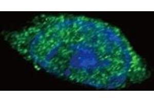 Confocal immunofluorescent analysis of JAK2 antibody with HeLa cells followed by Alexa Fluor 488-conjugated goat anti-rabbit lgG (green). (JAK2 antibody  (AA 1101-1132))