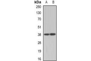 Western blot analysis of TEL2 expression in A431 (A), Hela (B) whole cell lysates.
