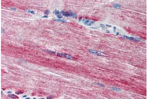 Human Skeletal Muscle (formalin-fixed, paraffin-embedded) stained with ACSL3 antibody ABIN301660 at 20 ug/ml followed by biotinylated goat anti-rabbit IgG secondary antibody ABIN481713, alkaline phosphatase-streptavidin and chromogen. (Acsl3 antibody  (N-Term))