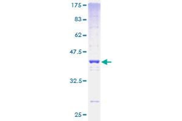 H2AFV Protein (AA 1-128) (GST tag)