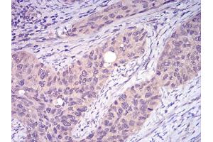 Immunohistochemistry (IHC) image for anti-TNF Receptor-Associated Factor 2 (TRAF2) (AA 39-188) antibody (ABIN5896378) (TRAF2 antibody  (AA 39-188))