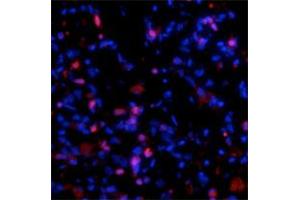 Immunofluorescence staining of fibrotic mouse lung tissue showing specific staining of COL1A1 molecules (red) that are still associated with the cells in which they were synthesized. (COL1A1 antibody)