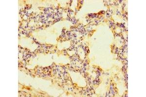 Immunohistochemistry of paraffin-embedded human lung tissue using ABIN7168465 at dilution of 1:100 (RUFY4 antibody  (AA 174-473))