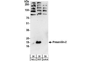 Western Blotting (WB) image for anti-Presenilin 2 (Alzheimer Disease 4) (PSEN2) (AA 275-325) antibody (ABIN7455024)