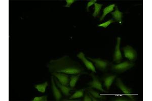 Immunofluorescence of purified MaxPab antibody to CDADC1 on HeLa cell.