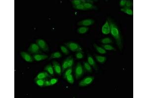 Immunofluorescent analysis of HepG2 cells using ABIN7164948 at dilution of 1:100 and Alexa Fluor 488-congugated AffiniPure Goat Anti-Rabbit IgG(H+L) (PSMA2 antibody  (AA 120-227))