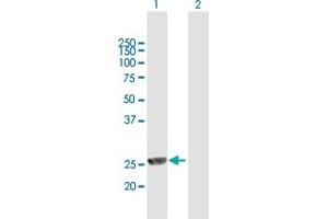 Western Blot analysis of MPHOSPH8 expression in transfected 293T cell line by MPHOSPH8 MaxPab polyclonal antibody.