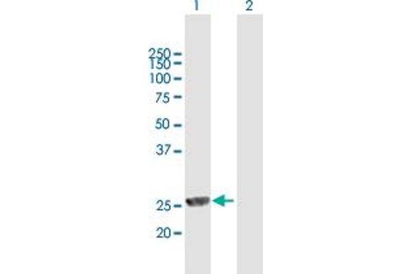 MPHOSPH8 anticorps  (AA 1-259)
