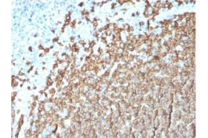 Formalin-fixed, paraffin-embedded human Tonsil stained with CD20 Mouse Monoclonal Antibody (MS4A1/3411).