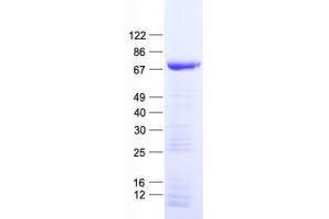 ZNF583 Protein (His tag)