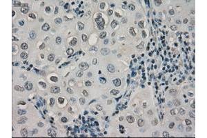 Image no. 7 for anti-Crystallin, alpha B (CRYAB) antibody (ABIN1497645) (CRYAB antibody)