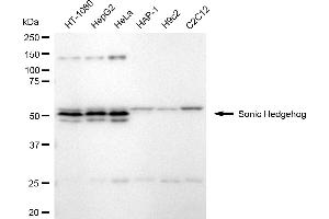 Western blotting analysis using sonic hedgehog antibody (ABIN7800969).