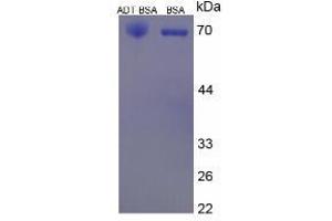 Image no. 2 for Androsterone (ADT) protein (BSA) (ABIN1880164)