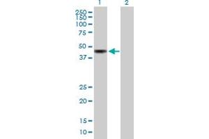 Western Blot analysis of KIAA0774 expression in transfected 293T cell line by KIAA0774 MaxPab polyclonal antibody. (CAZIP antibody  (AA 1-348))