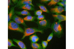 HeLa cell cultures stained with Ubiquilin 2 / UBQLN2 antibody (green) and chicken polyclonal antibody to vimentin (red). (Ubiquilin 2 antibody)