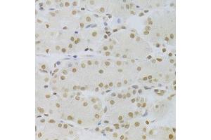 Immunohistochemistry of paraffin-embedded human stomach using HMGB1 Antibody. (HMGB1 antibody  (AA 100-200))